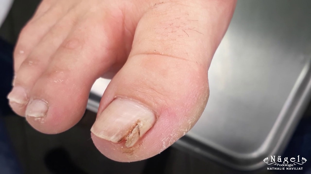 Isso é o que acontece quando você chuta uma pedra!