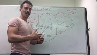 Parkinson's disease | Dopamine and the basal ganglia