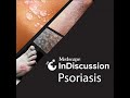 Cost Coverage And Psoriasis Overcoming Care Barriers