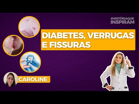 Thumbnail do vídeo