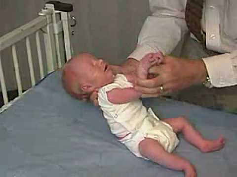 neurology exam: newborn-abnormal: Tone - Head Lag