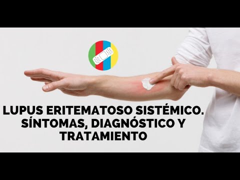 Systemic lupus erythematosus. Symptoms, diagnosis, and treatment