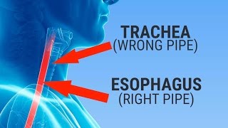 What happens when you swallow something down the &#39;wrong pipe&#39;