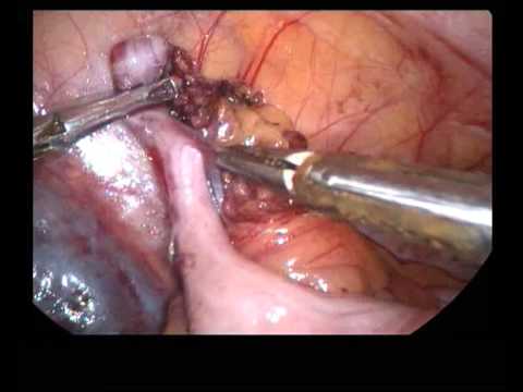 Rajani Hospital Video 4