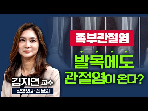 발목에도 관절염이 생길까요? 네 생깁니다! '족부관절염'의 모든 것