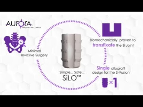 Aurora Spine: SiLO Surgical Technique Guide Animation