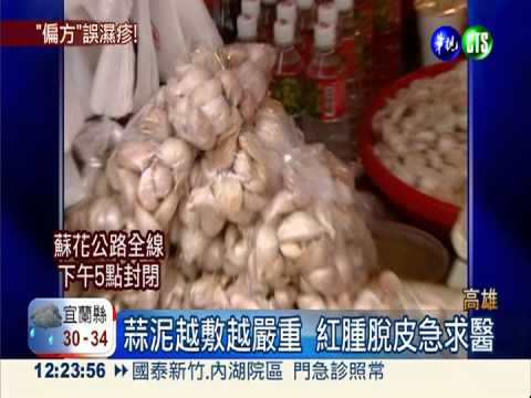 誤信偏方!濕疹敷蒜泥 發癢又灼傷