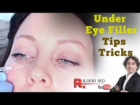 Under Eye Filler-Tps and Tricks