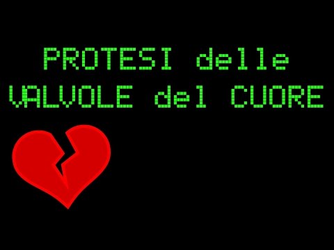 Depositi di sale nelle articolazioni e loro trattamento Forte dolore nella parte posteriore