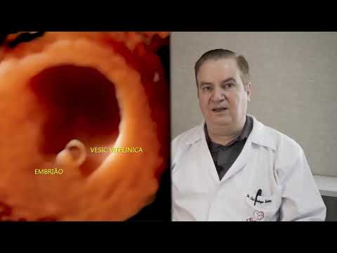 Quarta a Oitava Semana do Desenvolvimento Humano