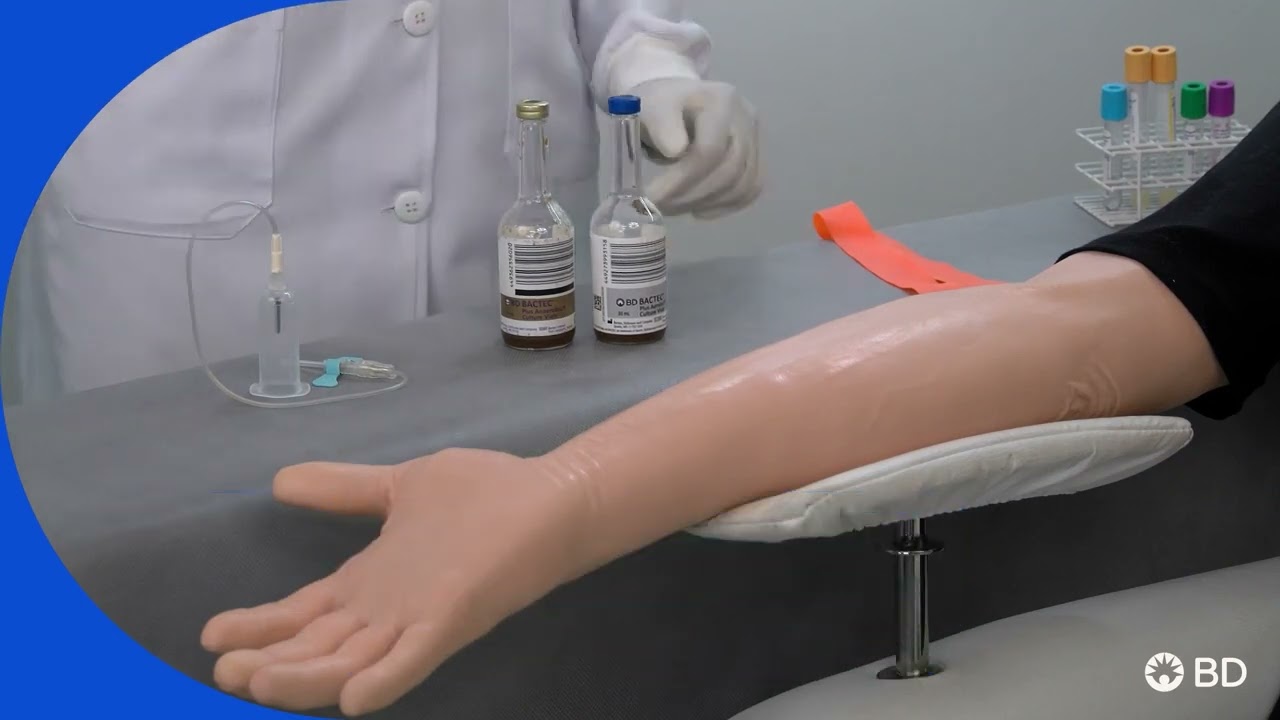 Coleta de Hemocultura: Passo a passo desse procedimento tão importante para a prática clínica