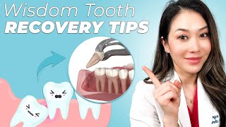 How to get better after wisdom tooth extraction