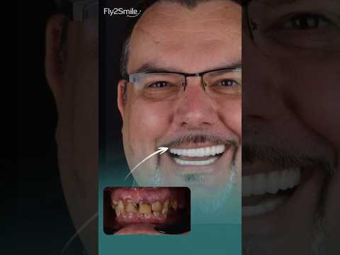 #Zahnimplantate in der Türkei – Fly2Smile