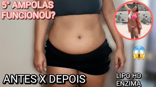 5° APLICAÇÃO DE ENZIMA (LIPO HD) ABDÔMEN, ANTES X DEPOIS 😱