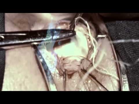 EAGULLS // HOLLOW VISIONS