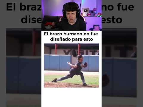 El Brazo Humano No Fue Creado Para Esto 💀