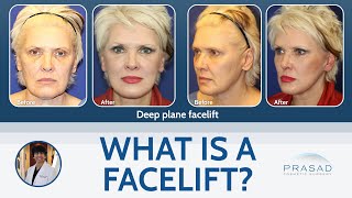 What is a Facelift?