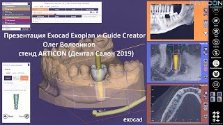 Презентация Exocad Exoplan и Guide Creator от Олега Воловикова на стенде ARTICON (Дентал Салон 2019)