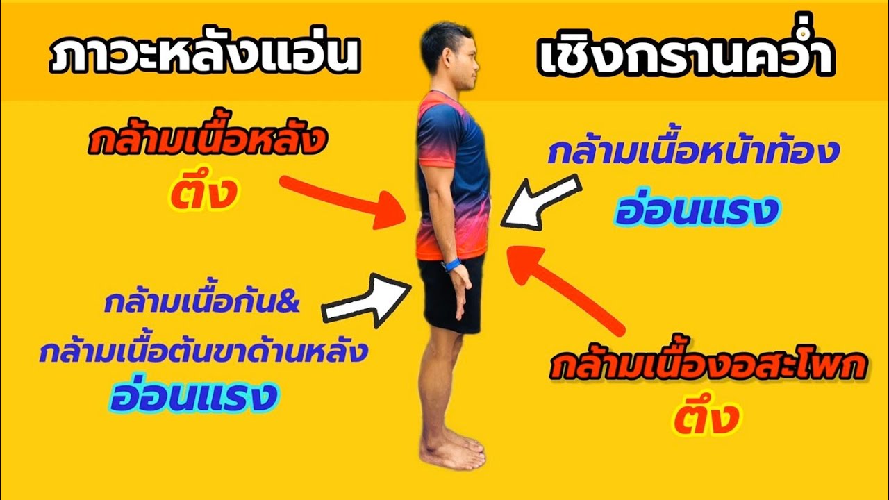 (AFITT Studio) Lower Crossed Syndrome