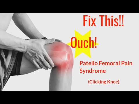 How to Fix Patellofemoral Pain Syndrome (Clicking Knee)（How to Fix Patellofemoral Pain Syndrome (Clicking Knee)）