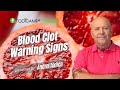 Warning Signs Of A Blood Clot Top 6 Early Indicators You Shouldn T Ignore