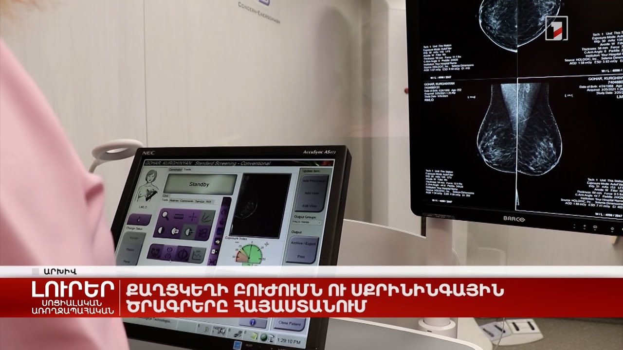 Քաղցկեղի բուժումն ու սքրինինգային ծրագրերը Հայաստանում