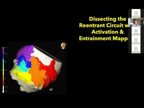 Virtual EP Fellows Conference 4 3 20 Rod Tung VT entrainment