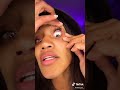 Eye contacts stuck in girl eye (very traumatized) #SHORTS