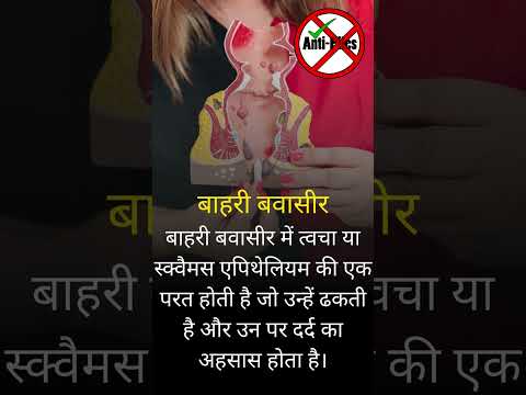 बवासीर के प्रकार  #antipiles #piles #hemorrhoidstreatment #bawasir#pileshemorrhoids #pilesclinic