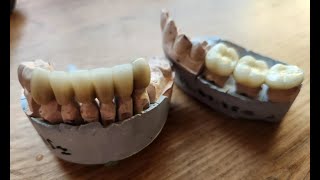 Поток сознания после визита к дантисту. Нет педофилам.