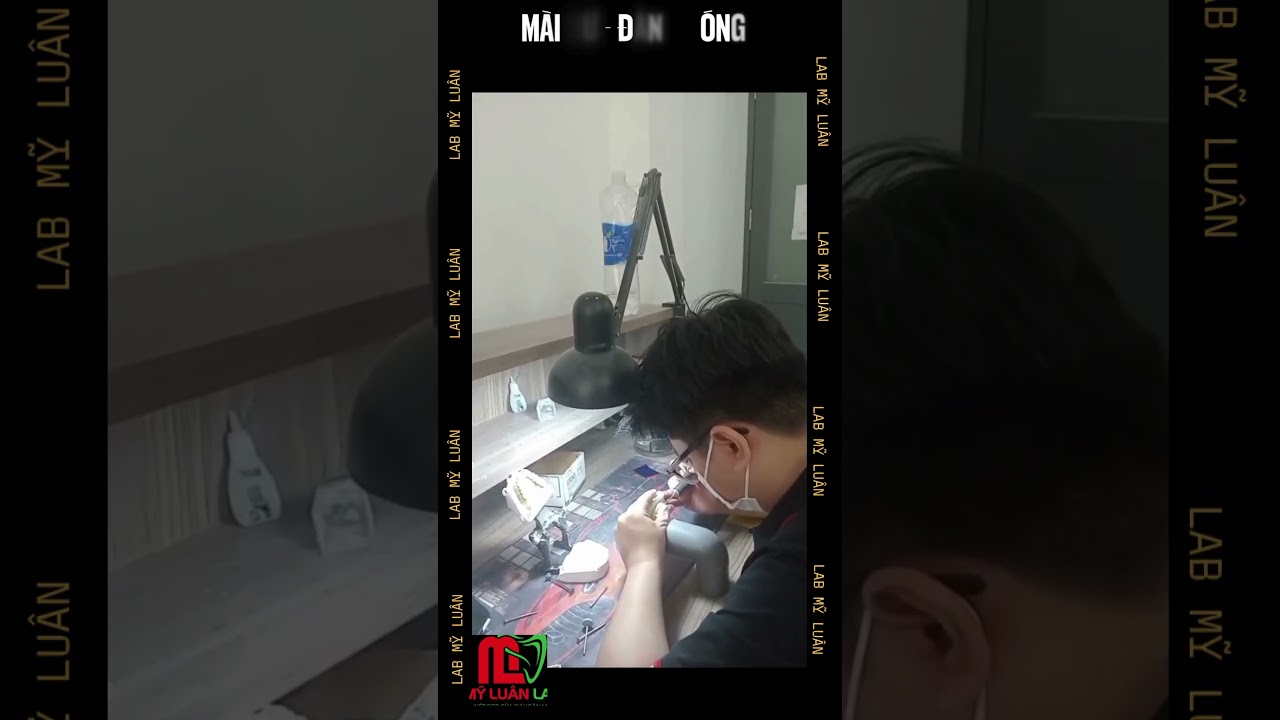 Hãy cùng Lab Mỹ  Luân tìm hiểu về quy trình sản xuất răng sứ