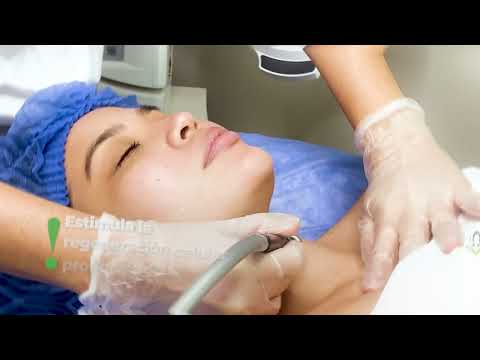 Microdermoabrasión Barranquilla - Centro de Estética Dario Cabello