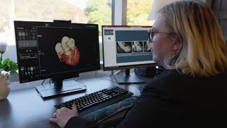 Making advanced cardiac CT accessible everywhere