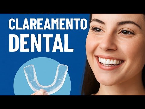 “Placa de Clareamento Dental: Passo a Passo Laboratorial COMPLETO!”