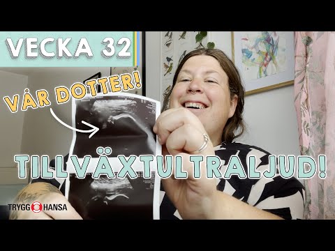 Förlossningsberättelse (på er begäran!) & ultraljud!   - Matilda & Emil vecka 32