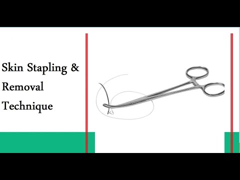 Skin Stapling & Removal Technique