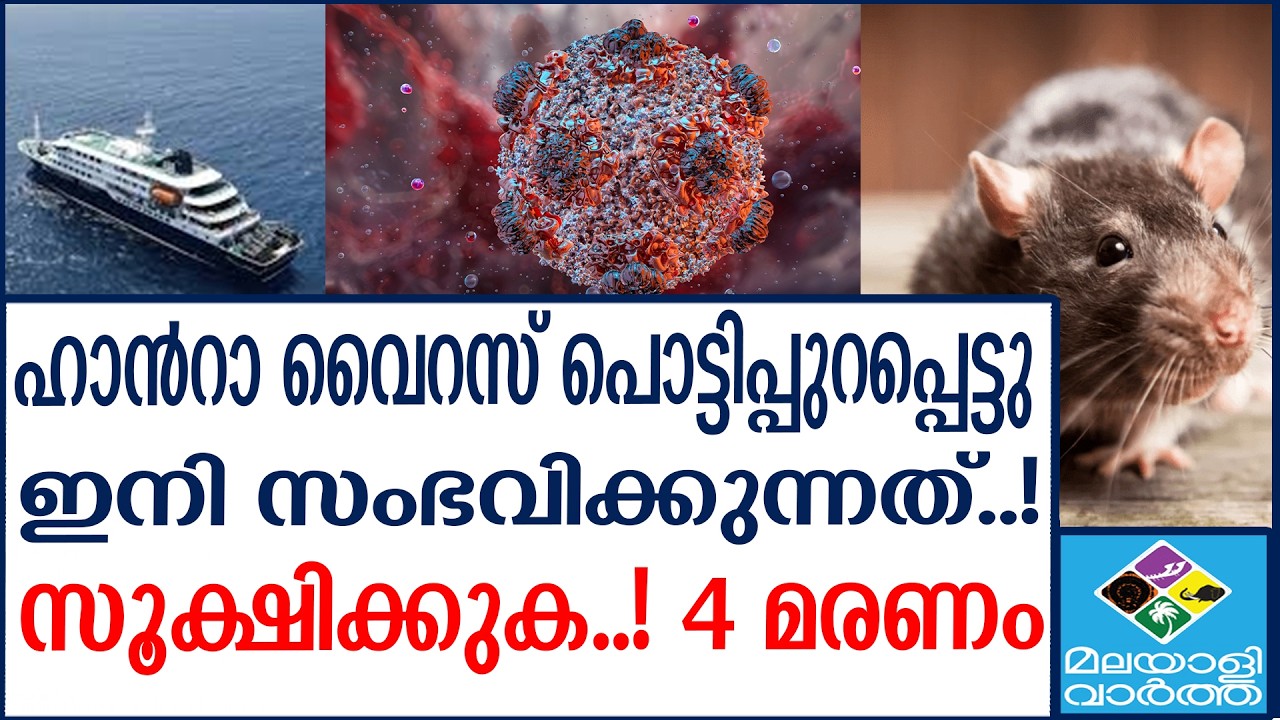 What is Hantavirus? Symptoms, Transmission What is Hantavirus? Symptoms, Transmission