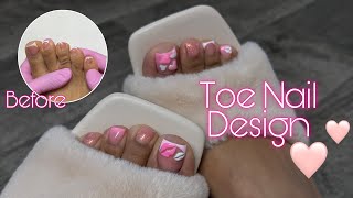 Doing my crusty toes at home! Molding Gel 3D Nail Art | Valentines Day Toe Nails