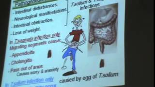 Dr Azza   Helminths  Sparganosis,Tenia Saginata,Tenia Solium   YouTube