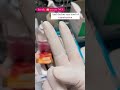 OBG GYN Examination Medical Womens Nursing