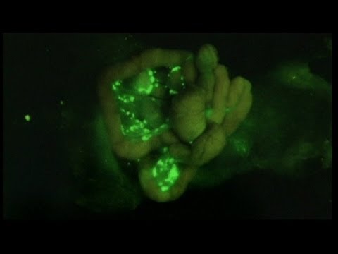 euronews science - Glow green for go: scientists develop cancer marker