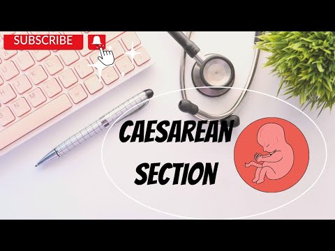 Caesarean Section - Includes types, indications, contraindications and complications
