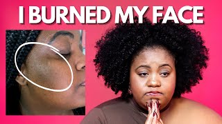 STOP DOING THIS! | FIVE Mistakes I Made On My Skincare Journey