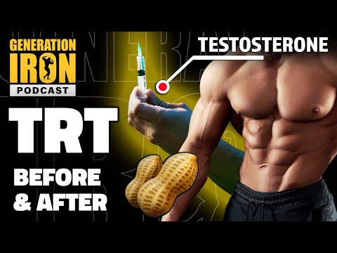 Before & After Using TRT: Pros & Cons Of Testosterone Replacement Therapy | GI Podcast