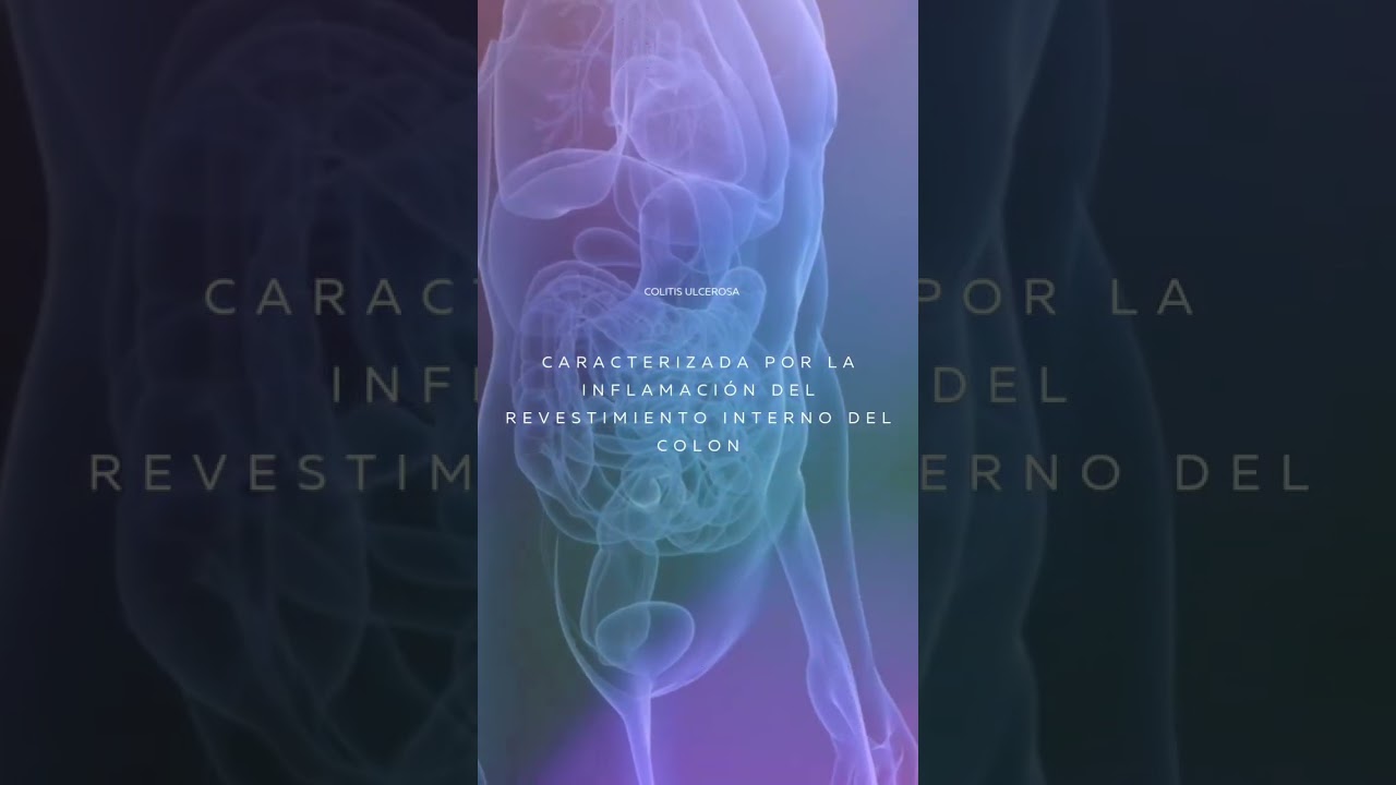 Juan Carlos Valle Cuna-8