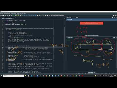 DI504 Foundations of Deep Learning "Coding UNET" (part II)