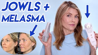30 Day Jowls Challenge Results: Envig Edge vs DermRays Revive: Which One Is Best for Mature Skin?