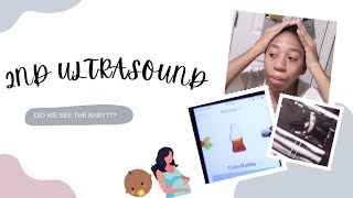 8 WEEK ULTRASOUND | PACK ORDERS WITH ME | PREGNANCY UPDATE