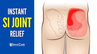 How to Relieve Sacroiliac Joint Pain in 30 SECONDS