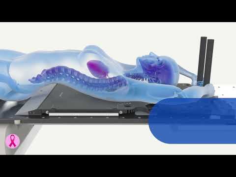 The Radixact® System, the Most Comprehensive Breast Cancer Treatment System